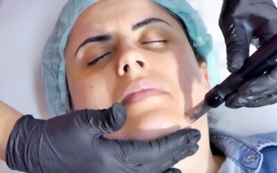 Curs Mezoterapie cu MICRONEEDLING